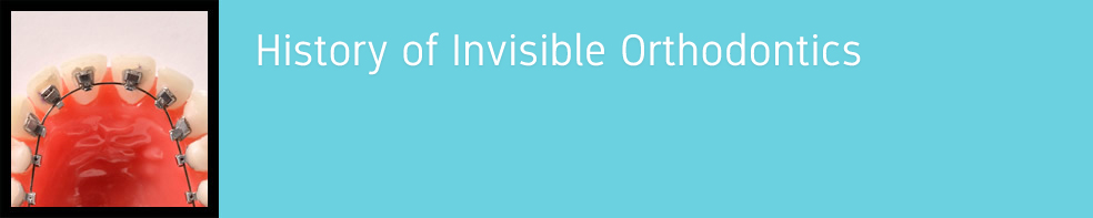 History of Invisible Orthodontics